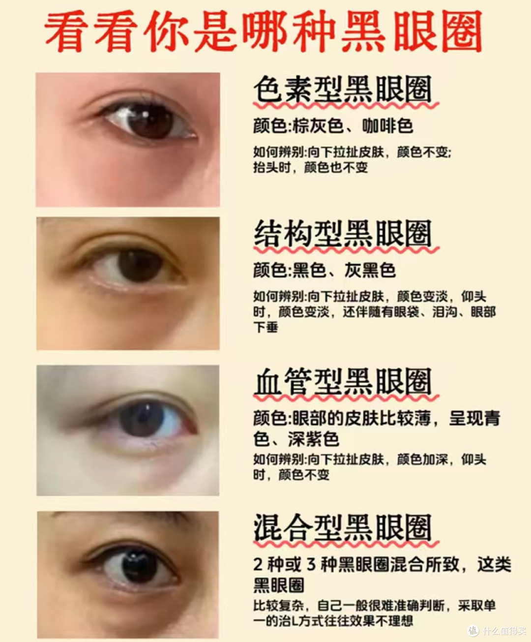 黑眼圈分类型吗?混合型黑眼圈怎么淡?CA冻干眼膜实测有效