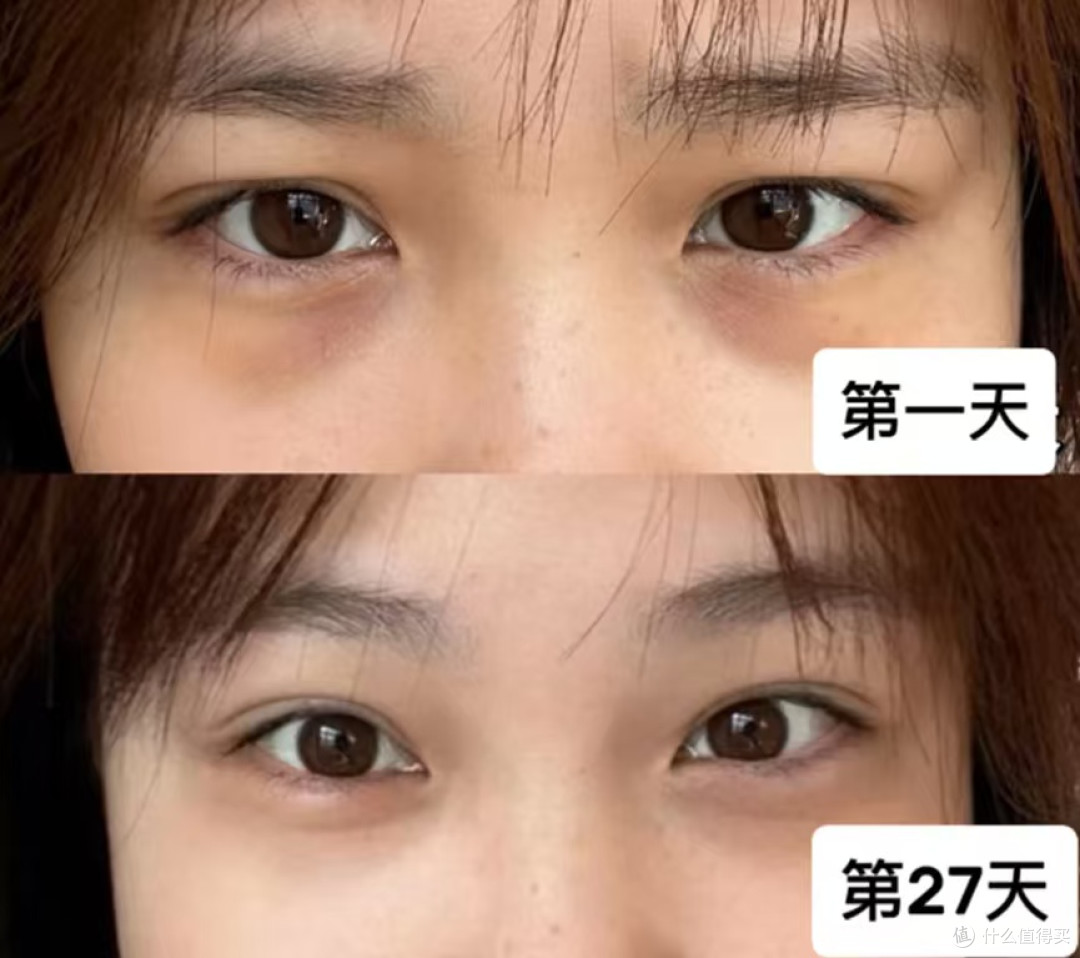 2026平价眼膜测评:热门6款实测,CA冻干眼膜消肿抗老实力出圈