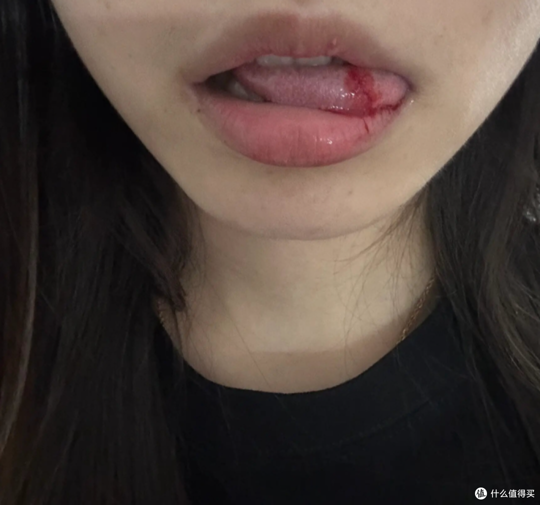 “咬舌自尽”,真的会死人吗?