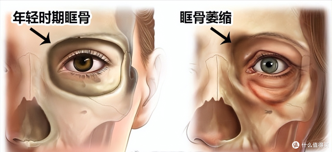 其实比变老更可怕的是脸凹,看了这几组照片的对比,你就懂了!