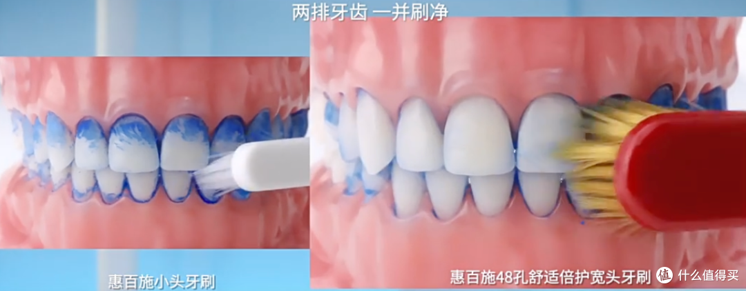 老人一口牙被全口拔光,最该反思的不止是医院