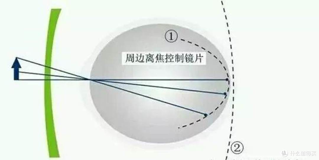 青少年离焦镜片怎么选？专业品牌与优质产品全面解析
