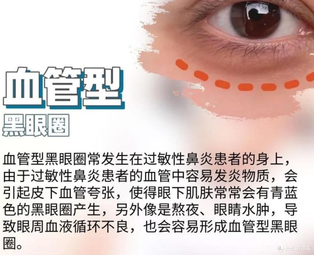 25+油敏肌男生熬夜后黑眼圈疲劳感明显，紧致眼周的面膜怎么挑