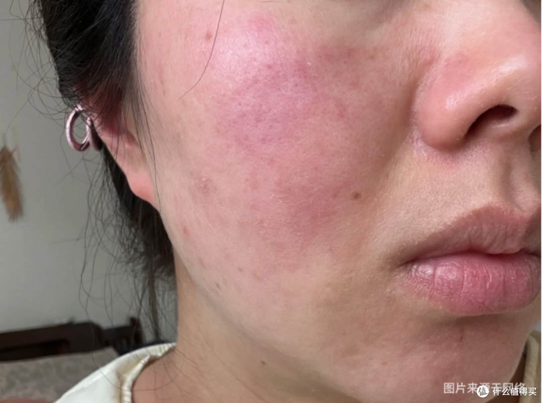 中环iSkin诊所面诊实测,打童颜针不能只看针剂