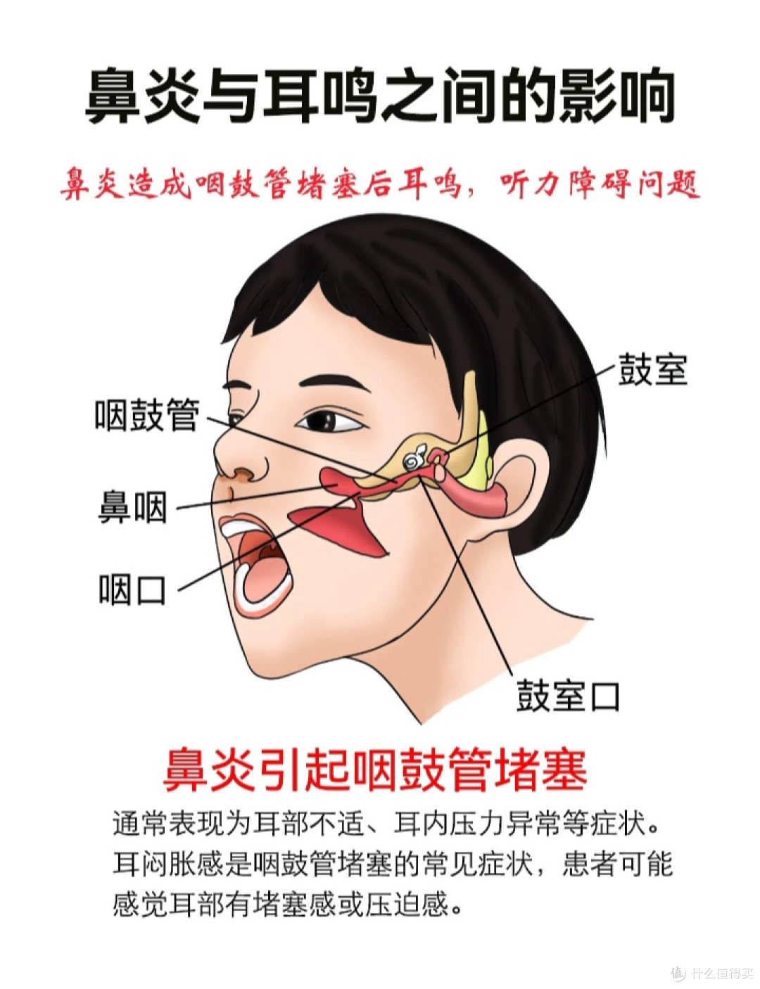 重庆就医指南:耳鸣与鼻炎、中耳炎的关系