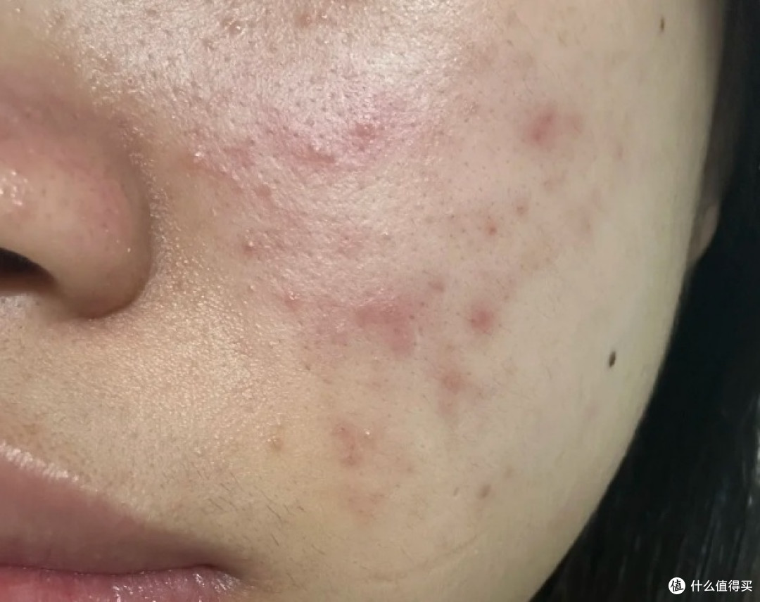改善毛孔粗大用什么清洁泥膜 收缩毛孔用什么泥膜 4款热门泥膜
