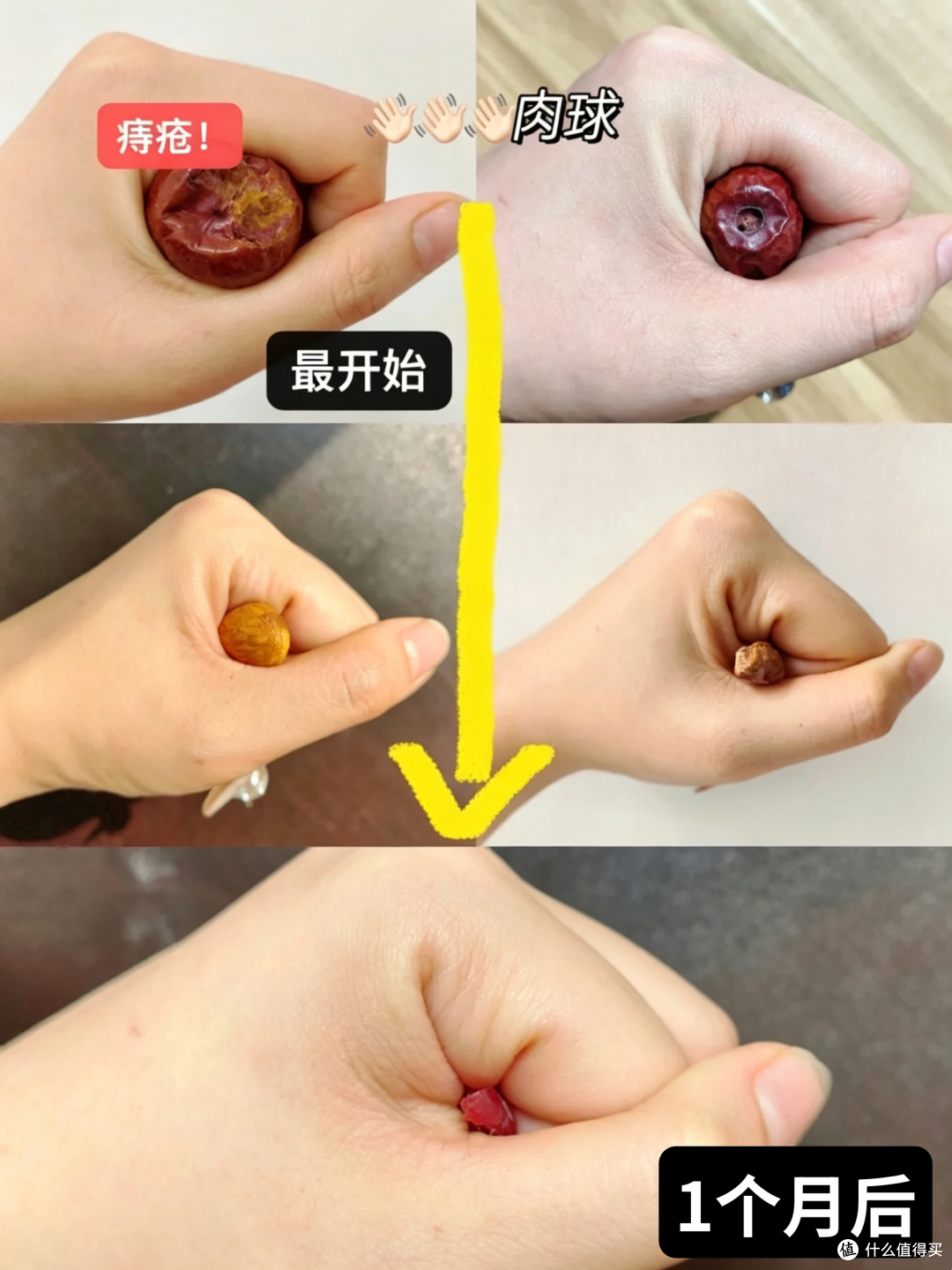 希望痔疮的家人们都能刷到