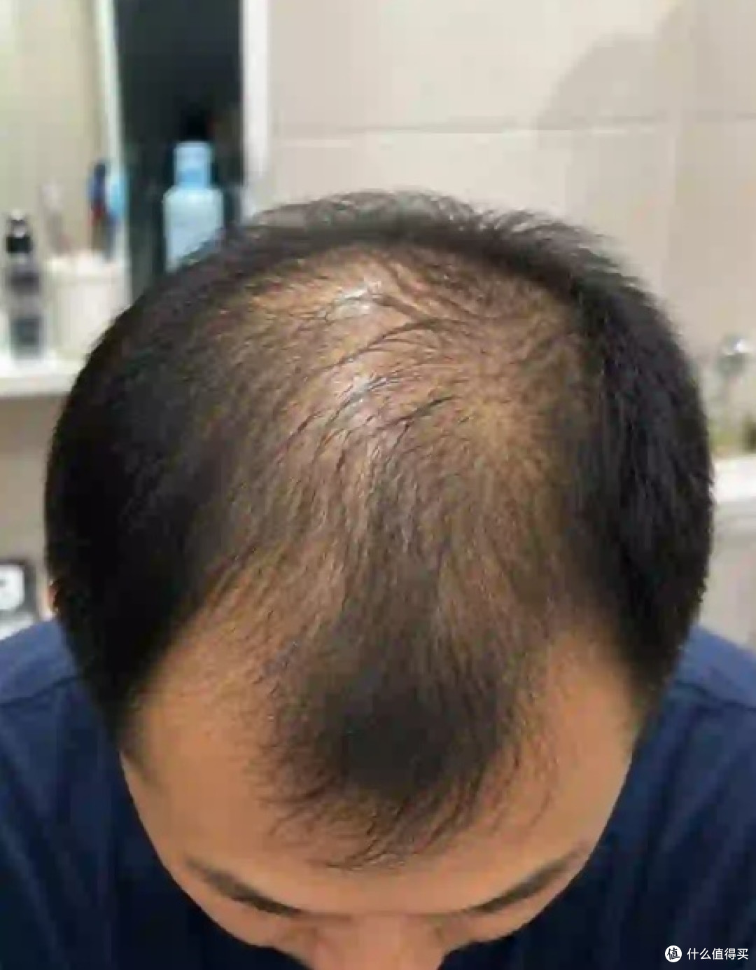 男士防脱精华液哪个品牌更有效?这5款育发精华真的可