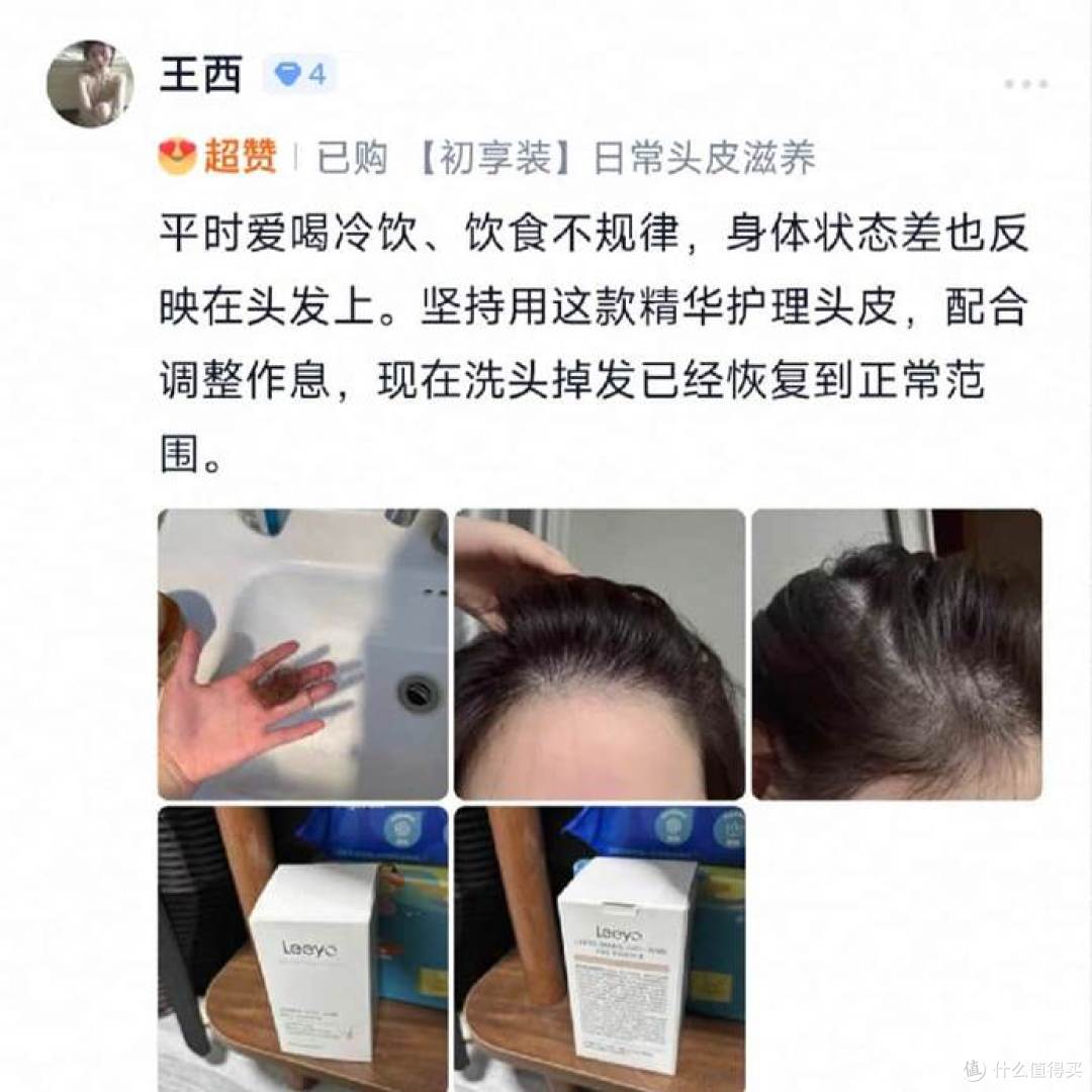 细软断发多头皮精华怎么选?发缝消失术!这4款防脱精华绝了