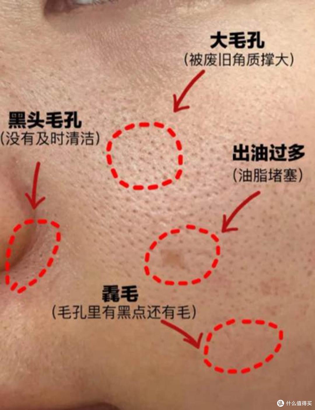 改善毛孔粗大用什么泥膜好？5款泥膜实测高效清洁细腻肤质