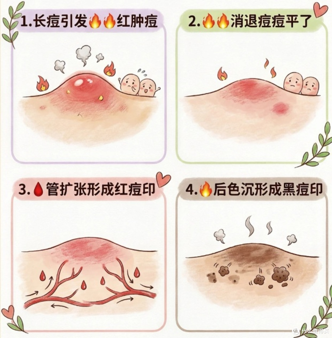 干皮痘印用哪款泥膜比较好?实测5款净颜实力派泥膜值得分享