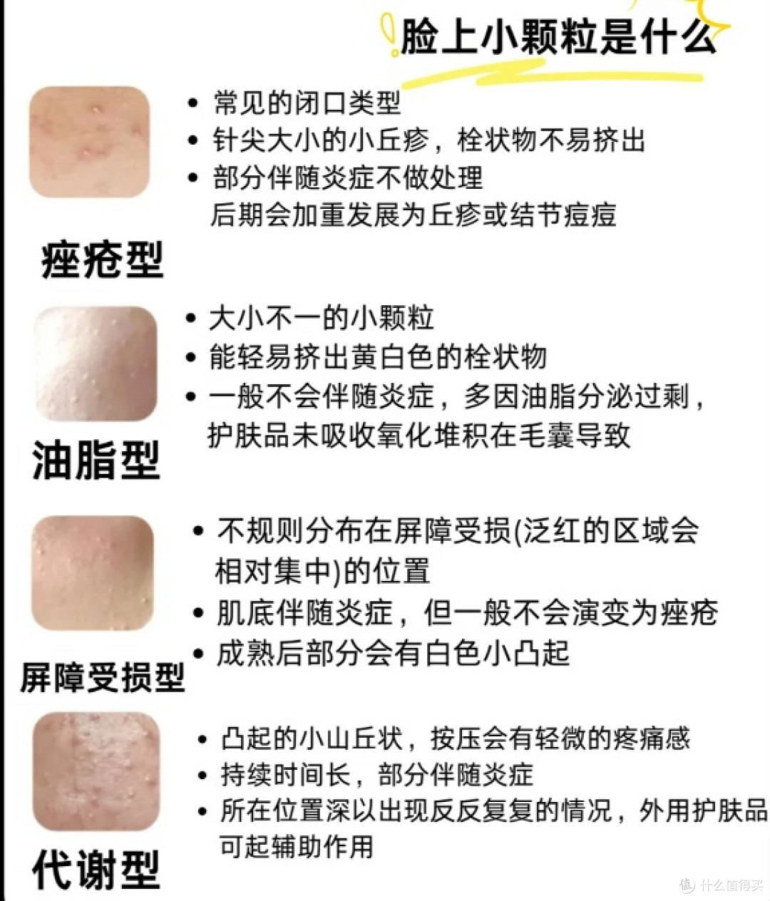 闭口反复长用哪款泥膜好?5款热门泥膜实测!疏通闭口的效果不错