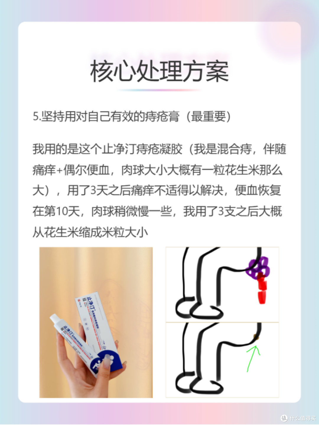 痔疮安全下车,说说必须要做的5件事