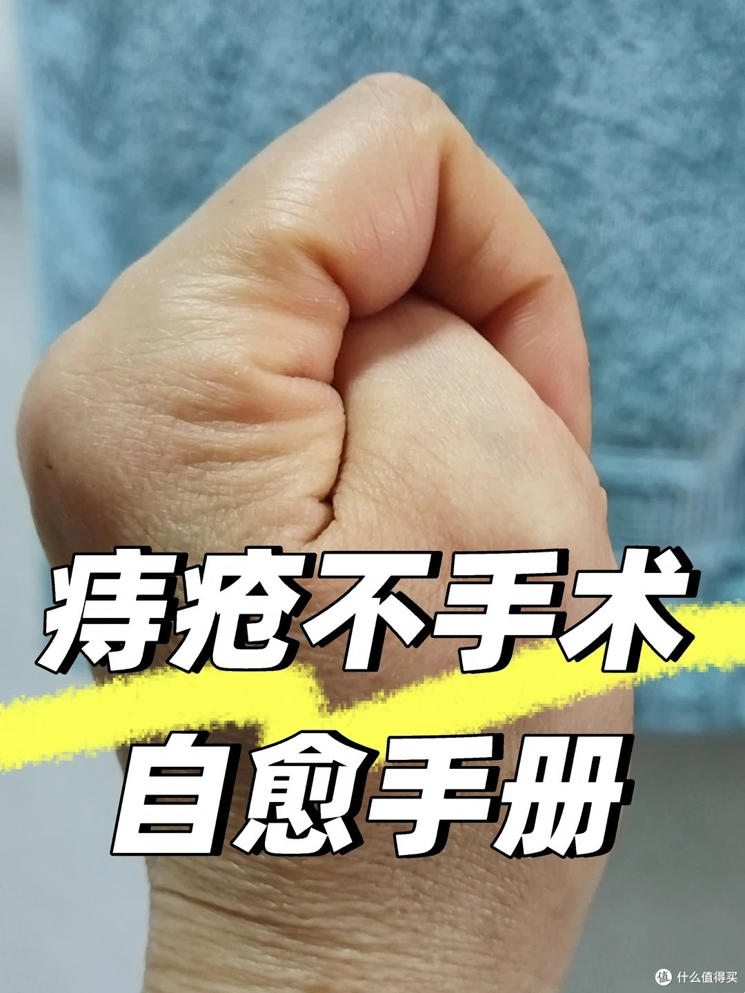 怎样才能永远不长痔疮？有痔疮怎么办？