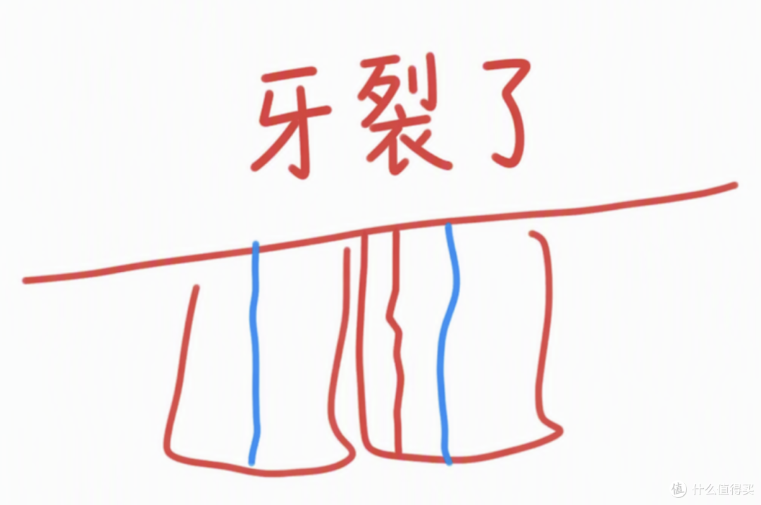 牙坏了无法修复!这个伤牙习惯,还在被很多人低估