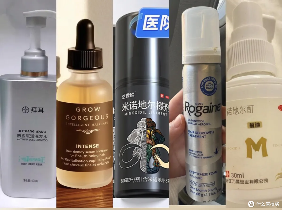 月入1.6亿的贝克汉姆也秃顶？脱发面前，众生平等