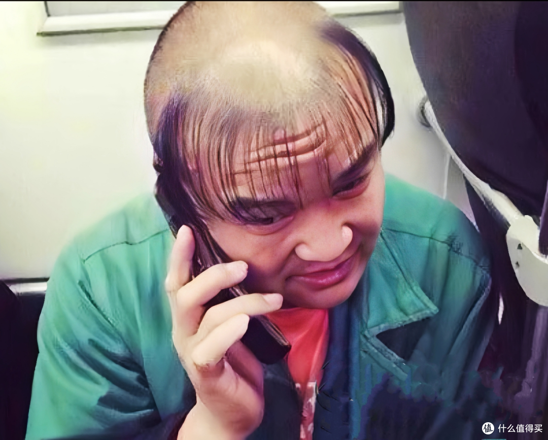 别再误解雄激素!男生秃顶,可能和它有关