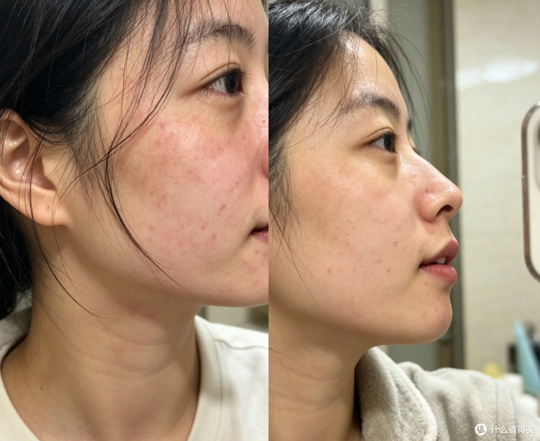 光电后脆皮护理不翻车：28天蛋白修护霜使用手记 热修期稳住屏障