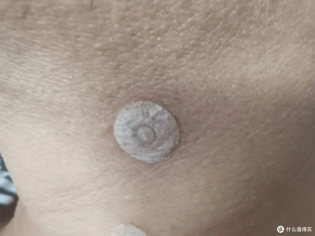 皮内针，约几毫米