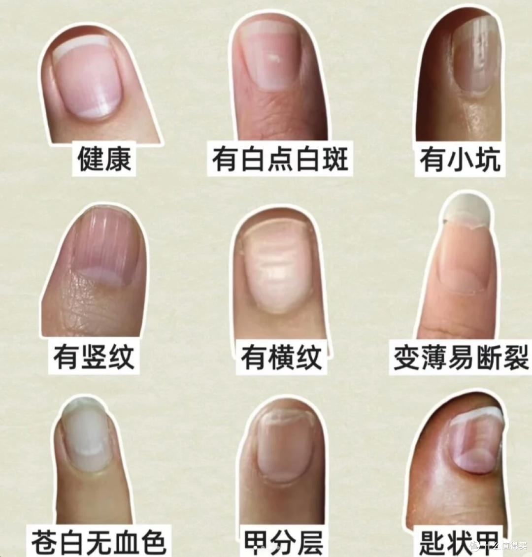 手上没有月牙,就是体虚?别被指甲传言骗了