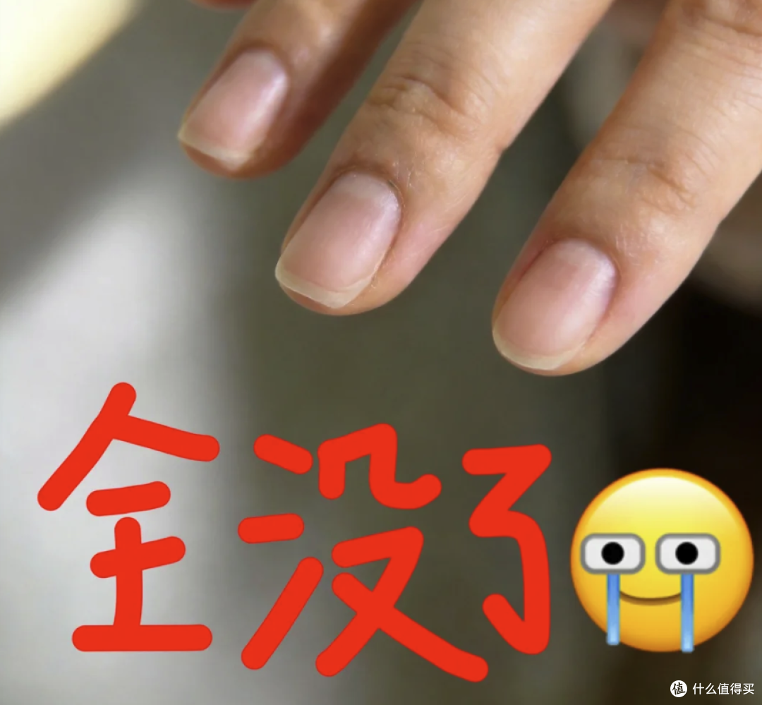 手上没有月牙,就是体虚?别被指甲传言骗了