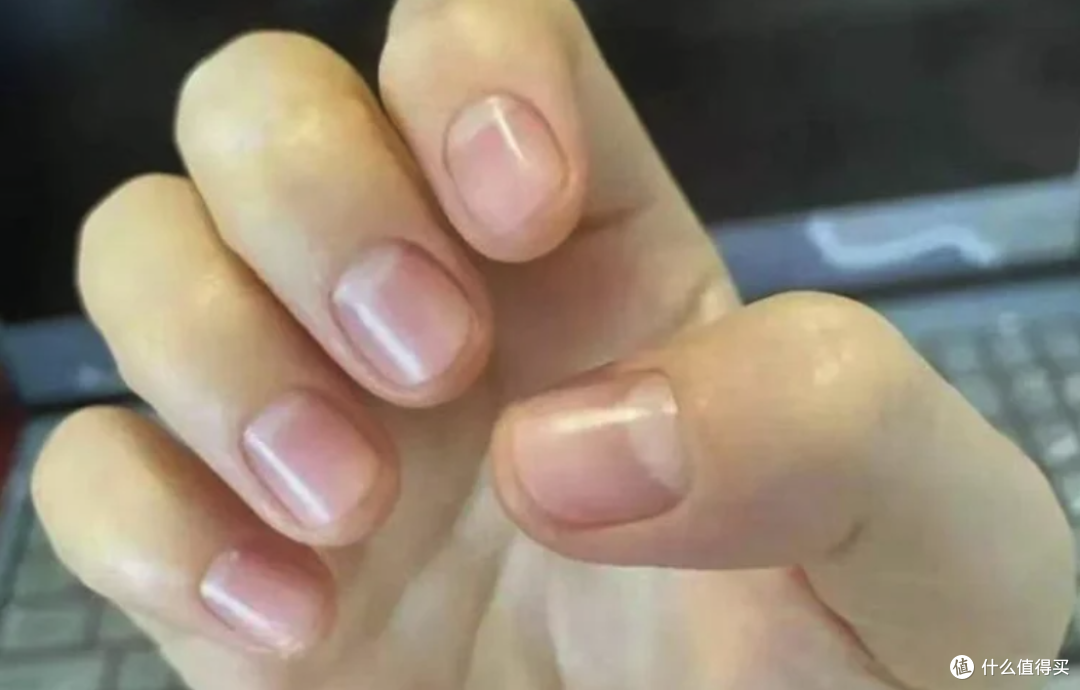 手上没有月牙,就是体虚?别被指甲传言骗了