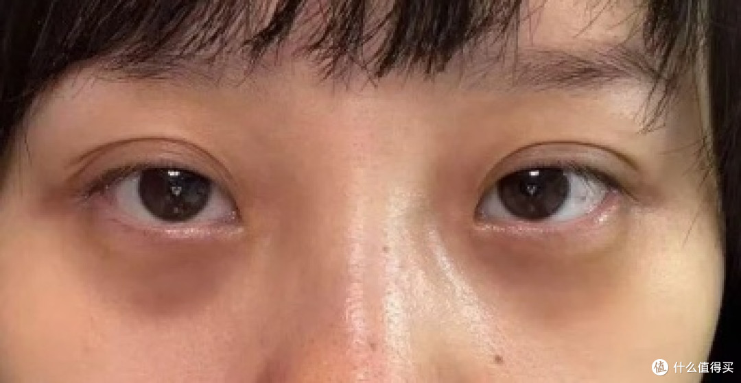 天生黑眼圈眼油有用吗?遗传眼圈较重姐妹2款眼油柔化先天黯沉