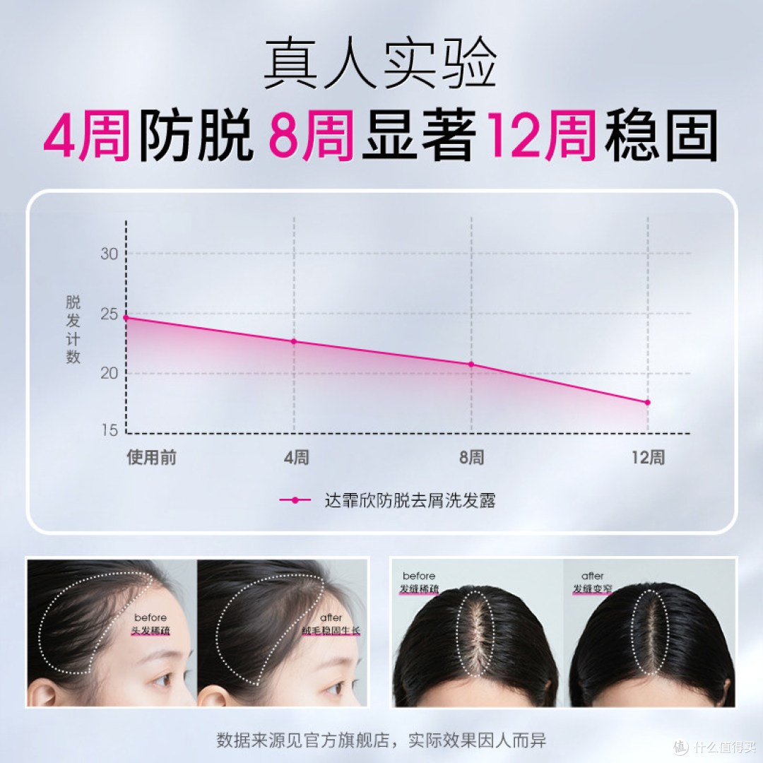达霏欣咖啡因洗发水体验,细软塌+油头亲测3周,掉发少了发根立了