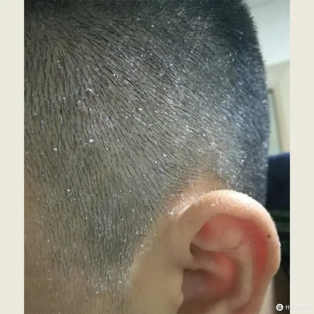 高温厨房工作者头屑多又出油，4款去油去屑洗发水抄作业