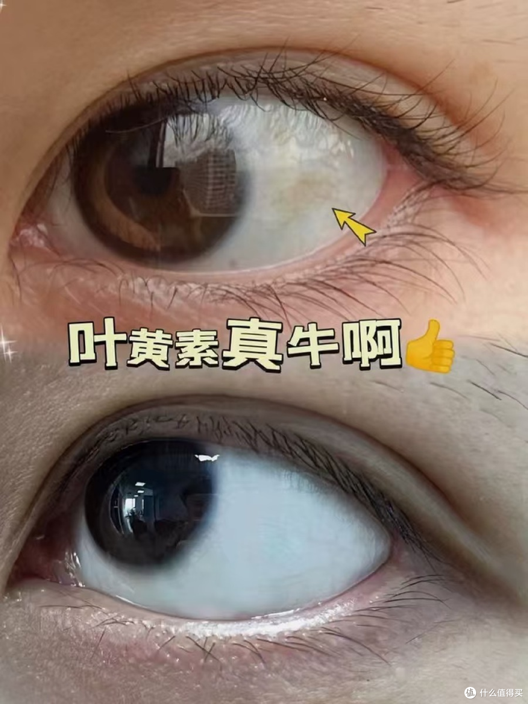 儿童防蓝光叶黄素怎么选,我会先看适龄和配方纯净度