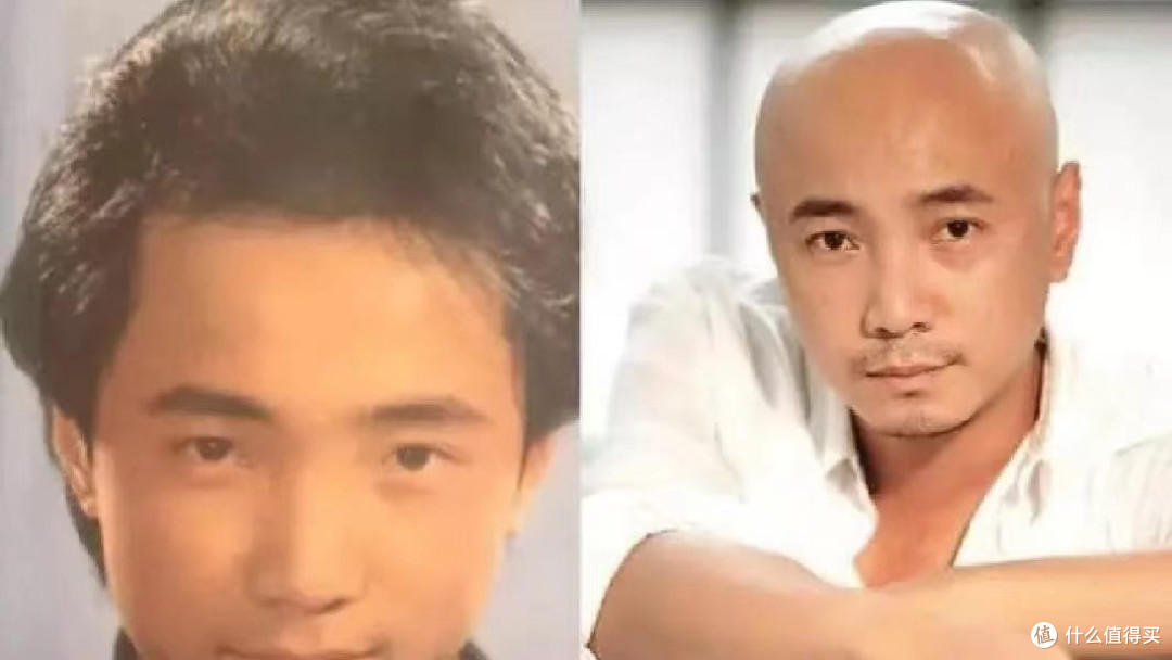 【头发篇】腿毛能扎小辫，头发却快掉光了。凭什么？