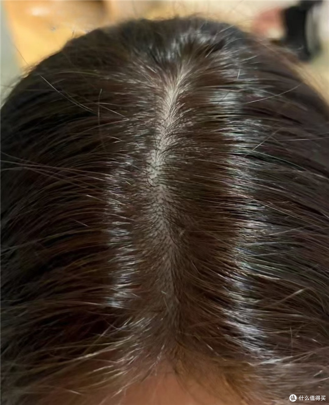 早晨洗头下午就塌？换季头屑反复怎么办，控油去屑洗发水这样选