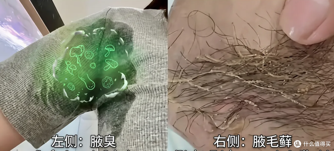腋毛竟然“挂霜”了!这洗不掉的"白霜"到底是啥,能直接刮掉不?