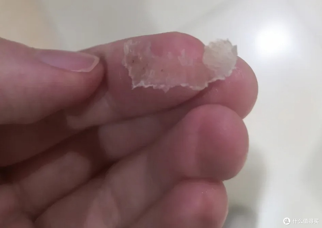 撕嘴皮上瘾，就算流血了还是一直撕，其实是身体疾病在暗示