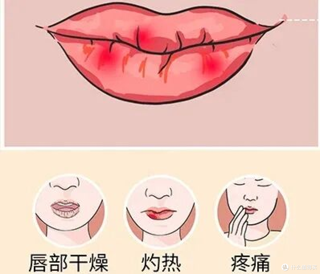 撕嘴皮上瘾，就算流血了还是一直撕，其实是身体疾病在暗示