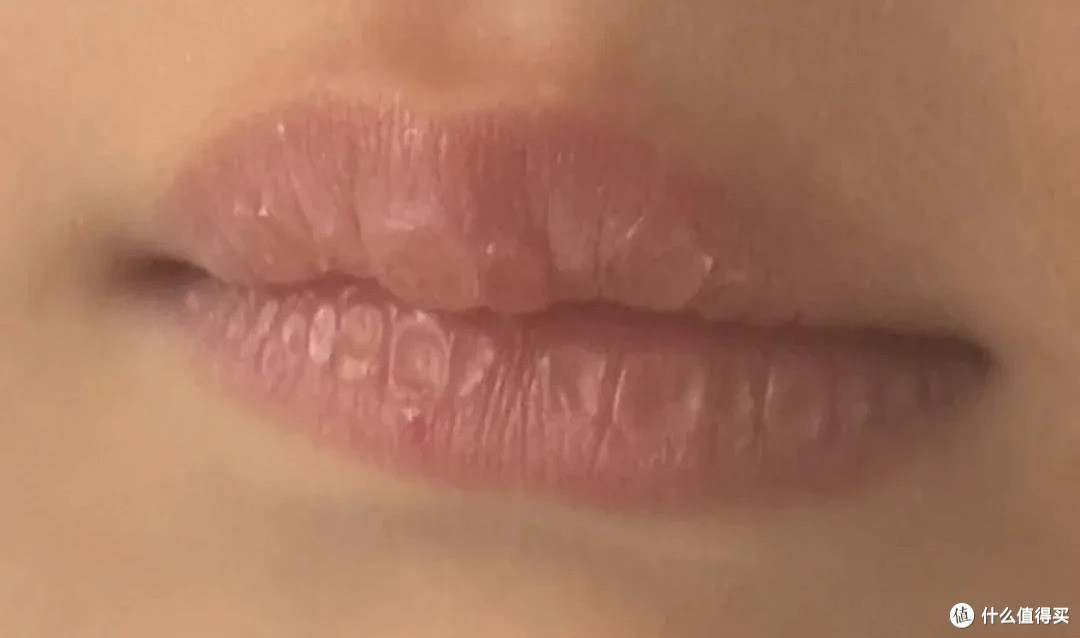 撕嘴皮上瘾，就算流血了还是一直撕，其实是身体疾病在暗示