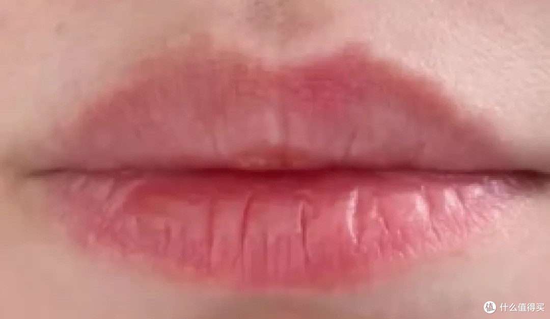 撕嘴皮上瘾，就算流血了还是一直撕，其实是身体疾病在暗示