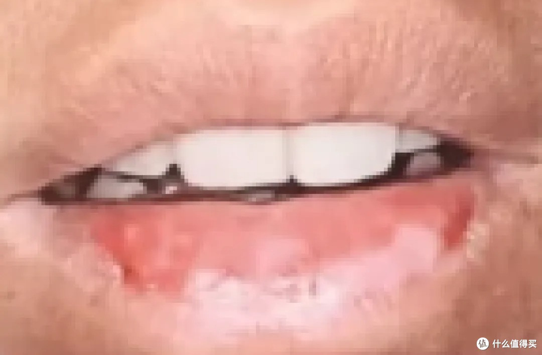 撕嘴皮上瘾，就算流血了还是一直撕，其实是身体疾病在暗示