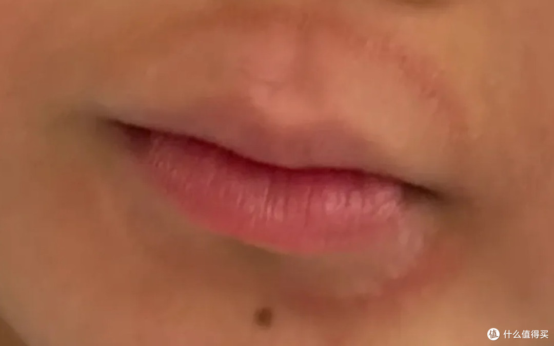 撕嘴皮上瘾，就算流血了还是一直撕，其实是身体疾病在暗示