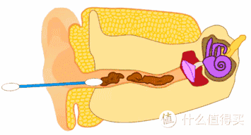 医生都叫别掏耳朵,真的不怕耳屎堵住吗?