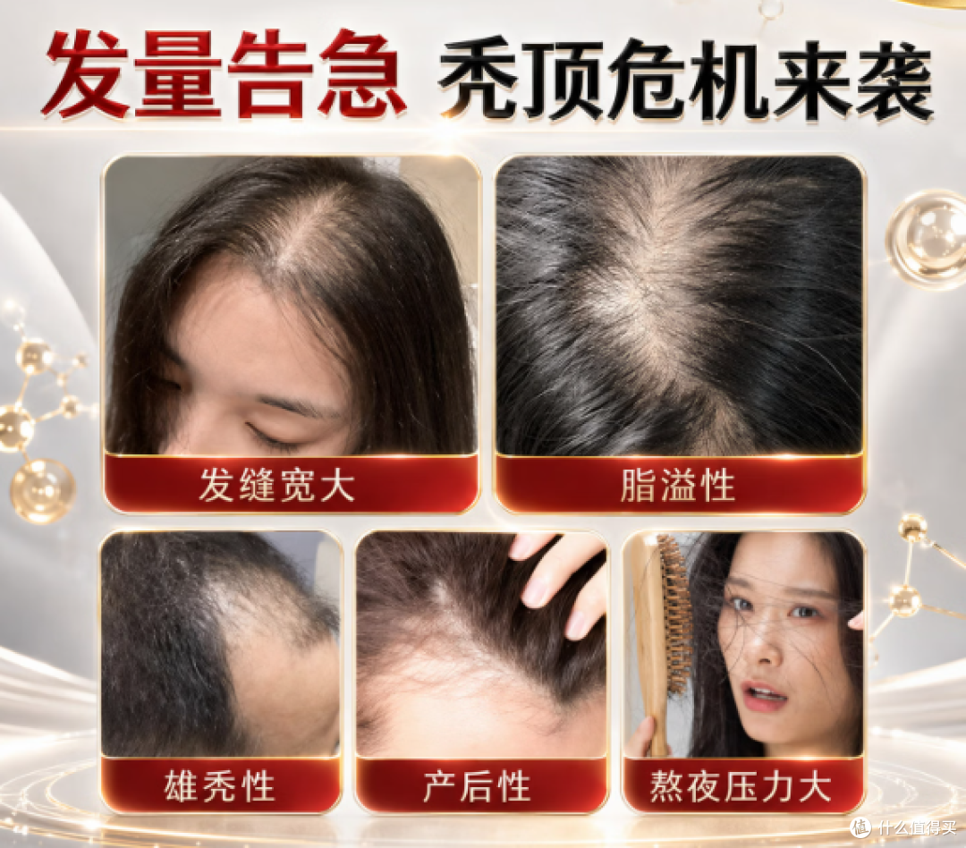 男生脱发一定要用米诺吗?4招教你少走弯路