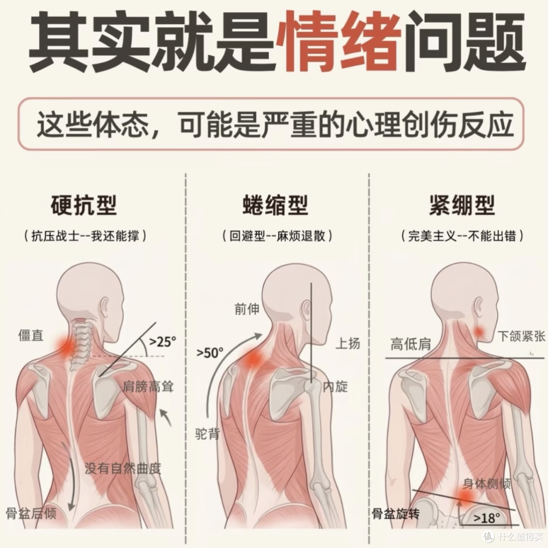 关于“脊柱侧弯”很多人都误解了,青少年与成人并不一样