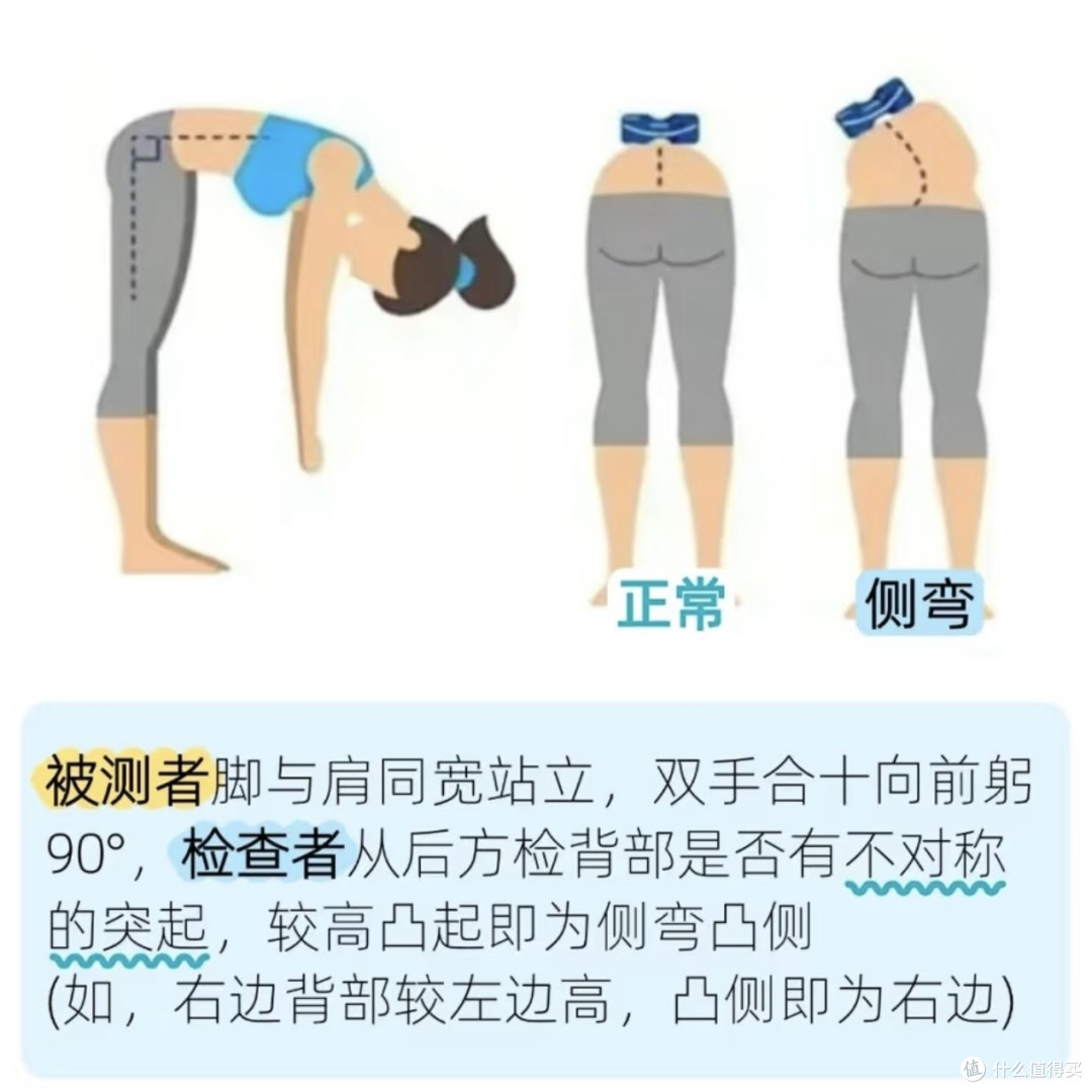关于“脊柱侧弯”很多人都误解了,青少年与成人并不一样