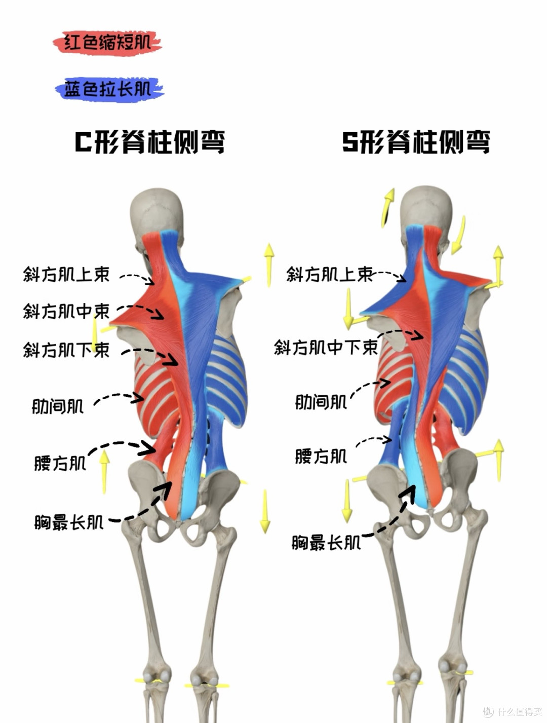 关于“脊柱侧弯”很多人都误解了,青少年与成人并不一样