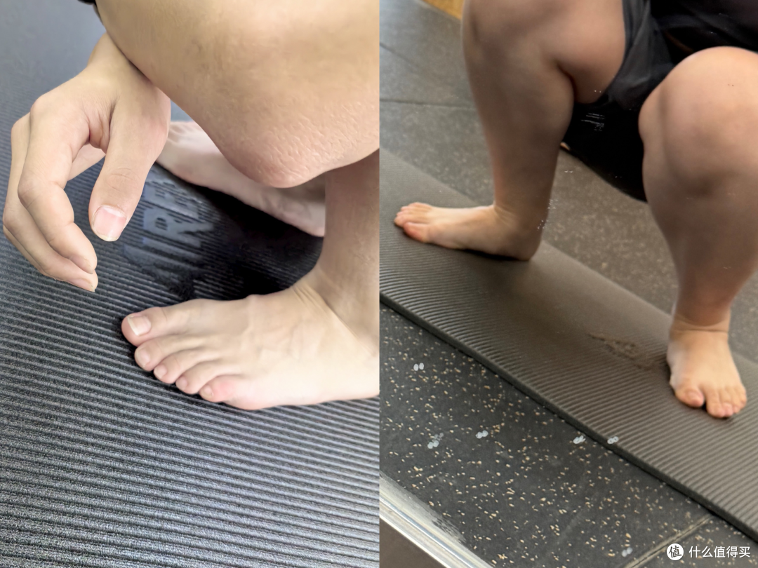 关于“脊柱侧弯”很多人都误解了,青少年与成人并不一样