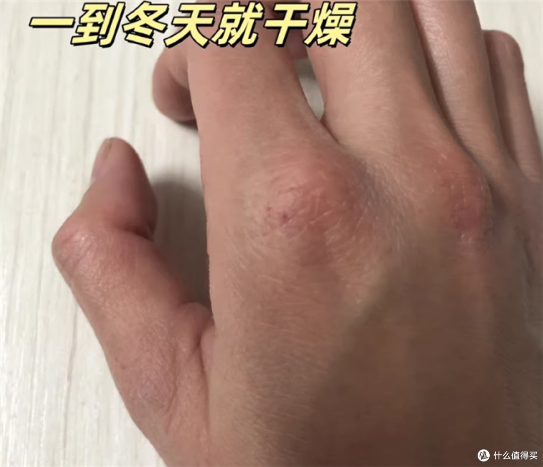 换季手背起倒刺的上班族,护手霜怎么选不踩雷?预算内5款实测