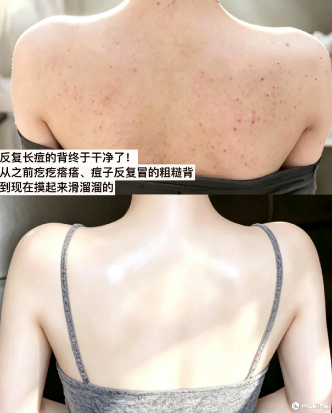 夏日后背护理实测多款身体喷雾横评,油背人踩坑之后找到合适选择