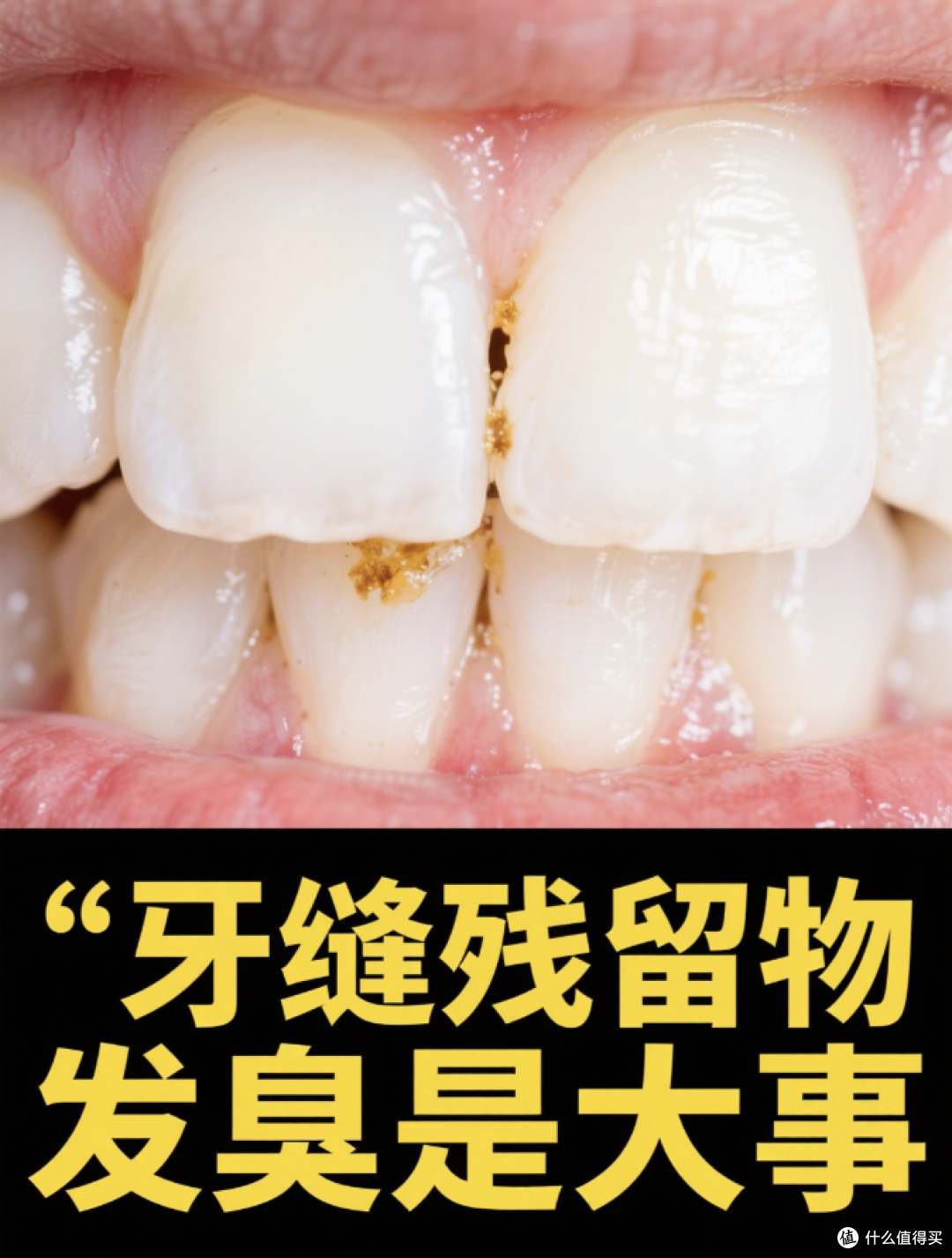 幽门螺杆菌为啥会口臭？3 条路径 + 根除后怎么护理，一次说清！