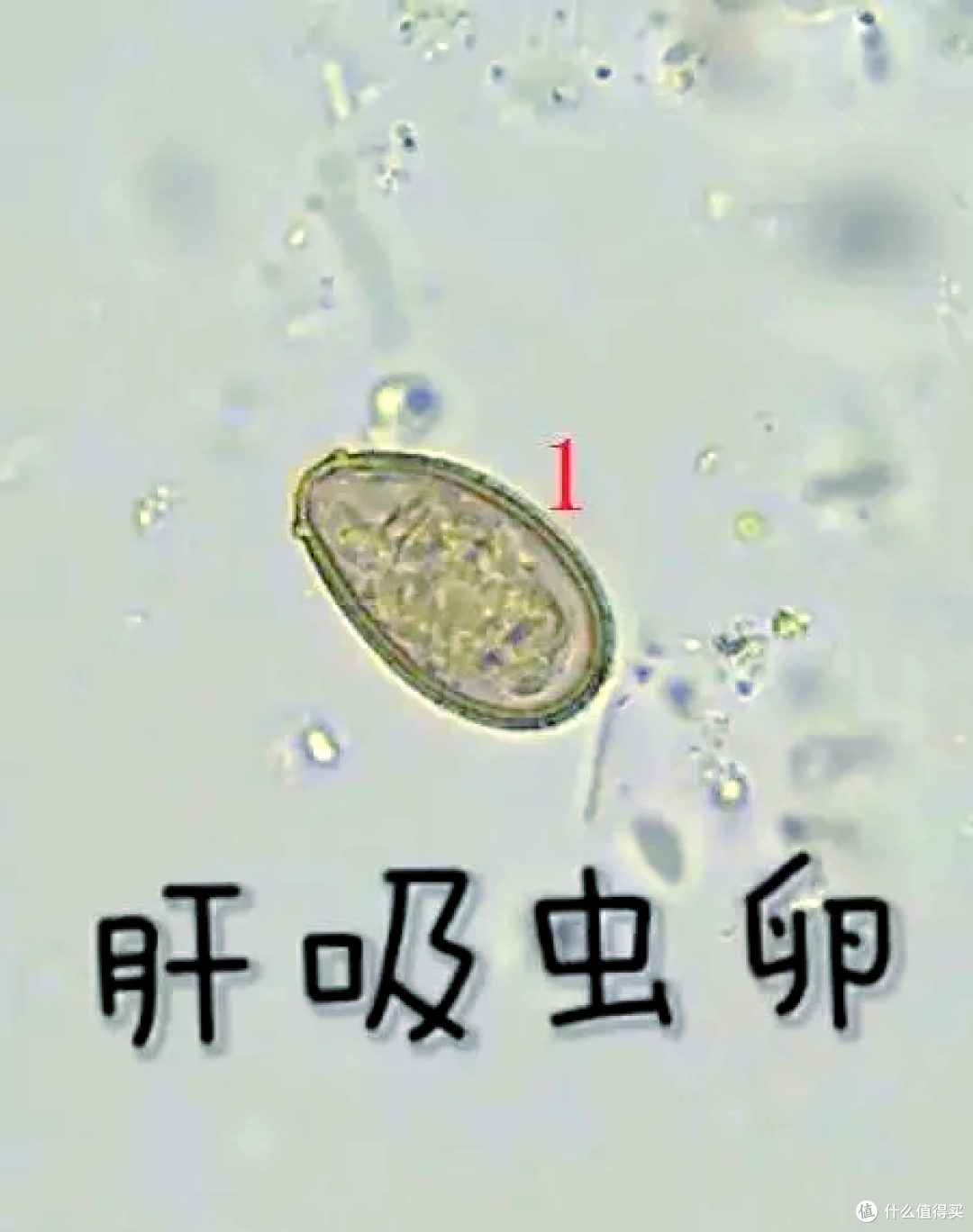 河南5人吃鱼生全中招!最容易染上寄生虫的5食物,别再乱吃了