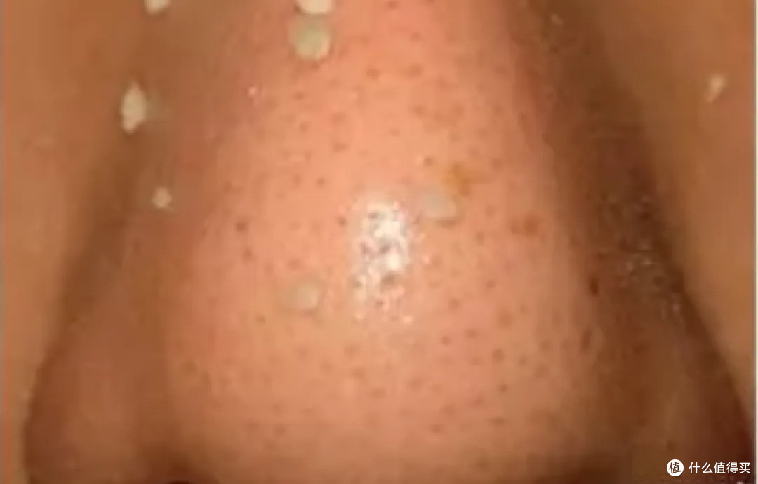试了十几种去黑头的方法,真正有效果的只有这一个